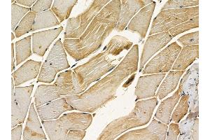 ABIN7095416 and ABIN7099473 at 1/100 staining mouse muscle tissue by IHC-P. (ST7 anticorps)