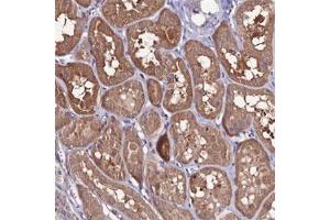 Immunohistochemical staining of human kidney shows moderate cytoplasmic positivity in tubular cells. (FZD8 anticorps)