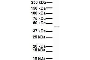 WB Suggested Anti-SLC27A2 antibody Titration: 1 ug/mL Sample Type: Human PANC1