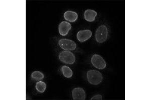 Indirect immunofluorescence staining of HeLa cells with Lbr polyclonal antibody . (Lamin B Receptor anticorps)