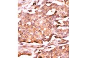 Image no. 1 for anti-RAD9 Homolog A (S. Pombe) (RAD9A) (pSer272) antibody (ABIN358200) (RAD9A anticorps  (pSer272))