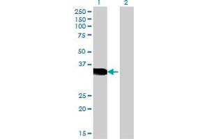 Western Blot analysis of CRX expression in transfected 293T cell line by CRX monoclonal antibody (M06), clone 4A12. (CRX anticorps  (AA 1-299))