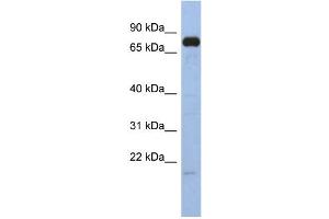 WB Suggested Anti-SIM1 Antibody Titration:  0. (SIM1 anticorps  (N-Term))