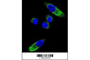 Confocal immunofluorescent analysis of CYP1A1 Antibody with MDA-MB231 cell followed by Alexa Fluor 488-conjugated goat anti-rabbit lgG (green).