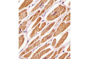 Antibody staining PDK4 in human heart tissue sections by Immunohistochemistry (IHC-P - paraformaldehyde-fixed, paraffin-embedded sections).