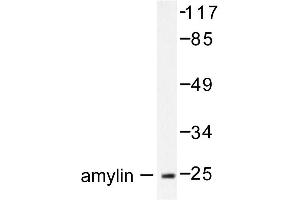 Image no. 1 for anti-Islet Amyloid Polypeptide (IAPP) antibody (ABIN271869) (Amylin/DAP anticorps)