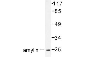Image no. 1 for anti-Islet Amyloid Polypeptide (IAPP) antibody (ABIN271869) (Amylin/DAP anticorps)