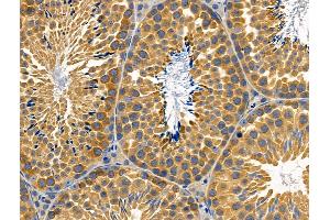 ABIN6259321 and ABIN6274774 at 1/100 staining Mouse testis tissue by IHC-P. (RPL26L anticorps  (C-Term))
