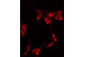 anti-Eukaryotic Translation Initiation Factor 4E (EIF4E) (pSer209) antibody
