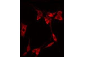 ABIN6267322 staining NIH-3T3 by IF/ICC. (EIF4E anticorps  (pSer209))