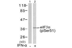 Image no. 1 for anti-Eukaryotic Translation Initiation Factor 2 Subunit 1 (EIF2S1) (pSer51) antibody (ABIN197047) (EIF2S1 anticorps  (pSer51))