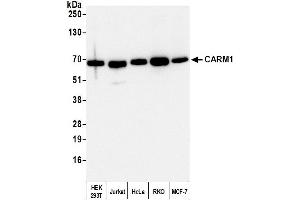 Western Blotting (WB) image for anti-Coactivator-Associated Arginine Methyltransferase 1 (CARM1) (C-Term) antibody (ABIN7454627)
