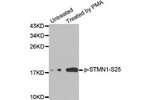 Western blot analysis of extracts from Jurkat cells, using Phospho-STMN1-S25 antibody. (Stathmin 1 anticorps  (pSer25))