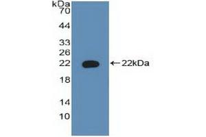 Detection of Recombinant BAD, Human using Polyclonal Antibody to Bcl2 Associated Death Promoter (BAD)