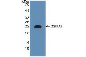 Detection of Recombinant BAD, Human using Polyclonal Antibody to Bcl2 Associated Death Promoter (BAD) (BAD anticorps  (AA 1-168))