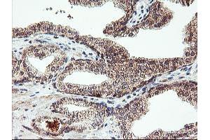 Image no. 3 for anti-1-Acylglycerol-3-Phosphate O-Acyltransferase 5 (Lysophosphatidic Acid Acyltransferase, Epsilon) (AGPAT5) antibody (ABIN1496498)