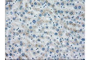 Image no. 2 for anti-Checkpoint Kinase 2 (CHEK2) antibody (ABIN1497500) (CHEK2 anticorps)