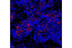 Immunofluorescence of paraffin embedded rat lymph node using MAP7 (ABIN7074621) at dilution of 1:400 (400x lens)