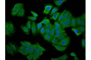 Immunofluorescence staining of HepG2 cells with ABIN7145359 at 1:66, counter-stained with DAPI. (SNTB1 anticorps  (AA 51-111))