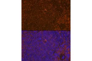 Immunofluorescence analysis of rat spleen using WASP Rabbit mAb (ABIN7271381) at dilution of 1:100 (40x lens).