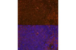 Immunofluorescence analysis of rat spleen using WASP Rabbit mAb (ABIN7271381) at dilution of 1:100 (40x lens).