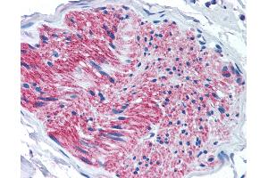 Anti-P2RX7 / P2X7 antibody IHC of human pancreas, nerve.