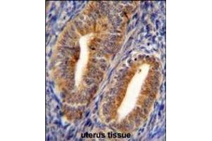 D Antibody (C-term) (ABIN655179 and ABIN2844796) immunohistochemistry analysis in formalin fixed and paraffin embedded human uterus tissue followed by peroxidase conjugation of the secondary antibody and DAB staining.