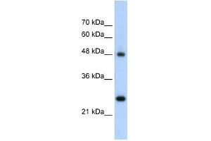 Chromogranin A antibody used at 5 ug/ml to detect target protein. (Chromogranin A anticorps)