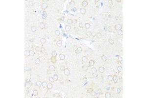 Immunohistochemistry of paraffin-embedded rat brain using EIF3J antibody.