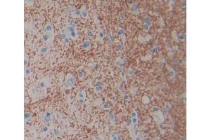 Used in DAB staining on fromalin fixed paraffin- embedded brain tissue
