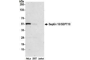 anti-Septin 10 (SEPT10) (AA 404-454) antibody