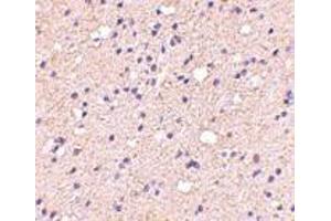 anti-ELOVL Fatty Acid Elongase 6 (ELOVL6) (N-Term) antibody