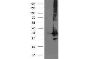 Image no. 1 for anti-Phenylethanolamine N-Methyltransferase (PNMT) antibody (ABIN1500306) (PNMT anticorps)