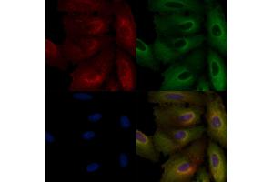 ABIN6265394 and ABIN6266638 staining  cells by IF/ICC. (Synaptophysin anticorps  (Internal Region))