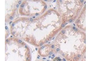 Detection of IFNa2 in Human Kidney Tissue using Polyclonal Antibody to Interferon Alpha 2 (IFNa2)