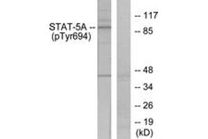 Western Blotting (WB) image for anti-STAT5 A/B (STAT5 A/B) (pTyr694) antibody (ABIN2888534) (STAT5 A/B anticorps  (pTyr694))