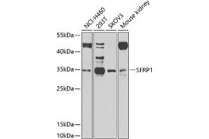 Western blot analysis of extracts of various cell lines, using SFRP1 antibody (ABIN1682675, ABIN1682676, ABIN5664178 and ABIN6219906) at 1:1000 dilution. (SFRP1 anticorps  (AA 30-314))