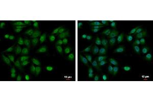 ICC/IF Image UBE2A antibody detects UBE2A protein at cytoplasm and nucleus by immunofluorescent analysis. (UBE2A anticorps)