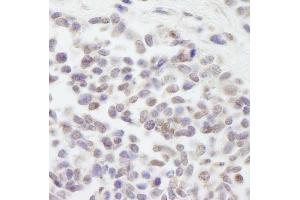 Immunohistochemistry (IHC) image for anti-Cullin 3 (CUL3) (AA 650-700) antibody (ABIN7448504)