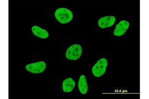 Immunofluorescence of monoclonal antibody to FLJ20097 on HeLa cell. (Syndetin/VPS50 anticorps  (AA 862-964))
