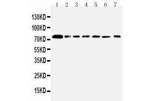 Anti-SPARCL1 antibody, Western blotting Lane 1: Rat Lung Tissue Lysate Lane 2: Mouse Lung Tissue Lysate Lane 3: PANC Cell Lysate Lane 4: A549 Cell Lysate Lane 5: COLO320 Cell Lysate Lane 6: MCF-7 Cell Lysate Lane 7:  Cell Lysate (SPARCL1 anticorps  (C-Term))