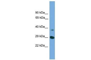 WB Suggested Anti-ATG16L1 Antibody Titration: 0. (ATG16L1 anticorps  (Middle Region))