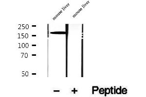 Western blot analysis of extracts of mouse liver tissue, using CPS1 antibody.