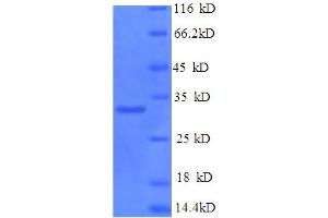 SDS-PAGE (SDS) image for Protein Kinase, DNA-Activated, Catalytic Polypeptide (PRKDC) (AA 3747-4015) protein (His tag) (ABIN5710145) (PRKDC Protein (AA 3747-4015) (His tag))