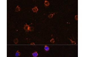 Immunofluorescence analysis of THP-1 cells using CD11B Polyclonal Antibody at dilution of 1:100. (CD11b anticorps)