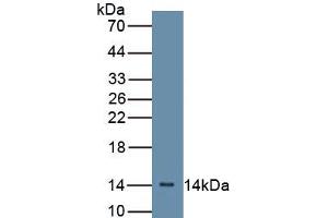 WB of Protein Standard: different control antibodies against Highly purified E. (Complement Factor B Kit ELISA)