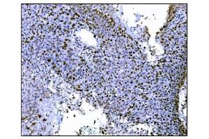 IHC analysis of Ki67 using anti-Ki67 antibody (ABIN7601100). (Ki-67 anticorps  (AA 2860-3256))