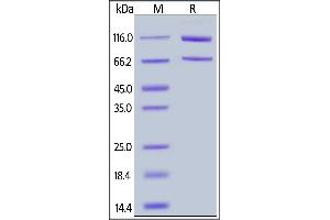 Cynomolgus Complement C5, His Tag on  under reducing (R) condition.