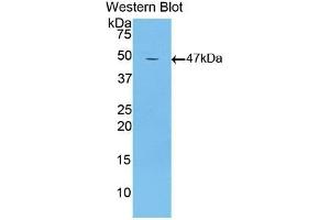 Detection of Recombinant LTbR, Mouse using Polyclonal Antibody to Lymphotoxin Beta Receptor (LTbR) (LTBR anticorps  (AA 128-395))