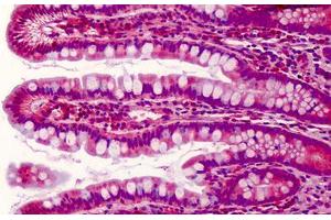 Human Small Intestine: Formalin-Fixed, Paraffin-Embedded (FFPE) (PDCD5 anticorps  (C-Term))